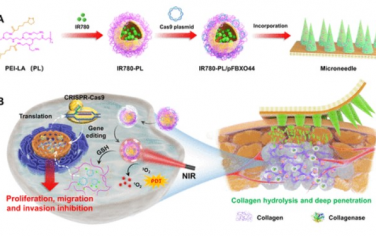 Nano Letters：微针实现光敏剂和CRISPR/Cas9系统的深层递送可实现有效的联合癌症治疗