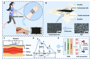 Science advances：通过深度学习辅助应变传感器阵列无需定位即可监测血压和心功能