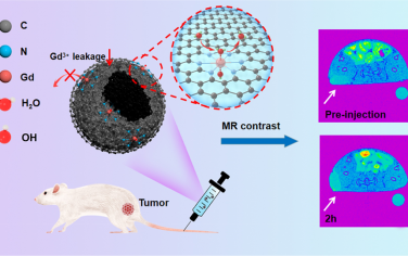 ACS Nano：具有高稳定性的单原子钆纳米造影剂用于肿瘤T1磁共振成像
