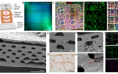 Biomaterials：堆叠血管移植物可在心梗心脏中实现密集血管性和快速整合