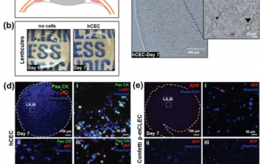 AFM： 使用功能性天然角膜来源的生物支架进行生物工程-再生医学眼表重建