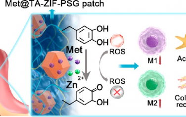 ACS Nano：二甲双胍-ZIF系统辅助聚多巴胺介导的免疫调节贴片用于糖尿病牙周组织再生