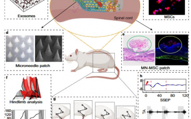 Nature Communications：多孔微针贴片持续递送细胞外囊泡以缓解脊髓损伤