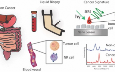 Nano Letters：肿瘤相关自然杀伤细胞的DNA甲基化标记可实现结直肠癌诊断