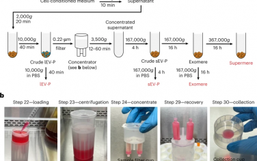 Nature Protocols：细胞外囊泡和纳米颗粒的全面高效分离方法