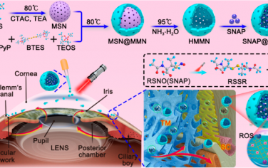 ACS Nano：可清除过氧亚硝酸盐的有机二氧化硅纳米药物用于光控NO释放和精准按需的青光眼治疗