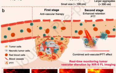 Biomaterials：pH响应性NIR-II光学诊疗制剂用于原位监测肿瘤血管和抗血管/光热联合治疗