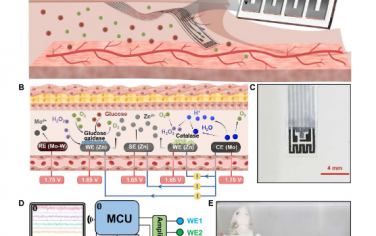 Sci. Adv.：用于血糖连续监测的电偶联型全印刷自补偿生物可吸收电化学装置