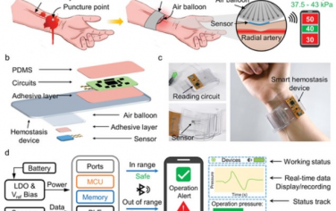 Advanced Functional Materials：具有全软传感系统的无线智能止血器件可进行定量和实时压力评估