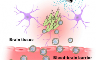 Biomaterials：磁靶向外膜囊泡可在细菌性脑膜炎中声动力根除耐抗生素细菌