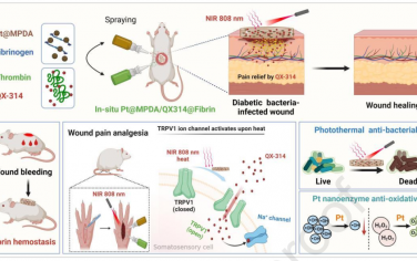 Biomaterials：近红外光激活的镇痛纳米复合材料递送系统用于治疗大鼠糖尿病创面