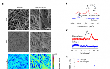 Nature Biomedical Engineering：骨基质矿化，会抑制癌症转移