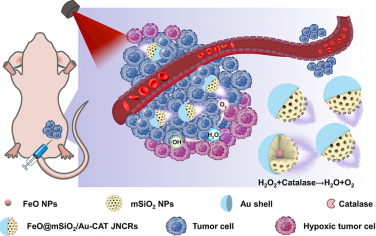 JACS：磁共振成像指导的自驱动Janus纳米催化机器人用于增强肿瘤穿透和治疗