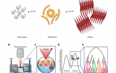 Science Advances：人工智能耦合等离子体红外传感器用于检测神经退行性疾病中的结构蛋白生物标志物