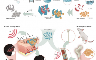 Biomaterials：富含氧空位的碳化钼MXene纳米网络用于超声催化的细菌根除
