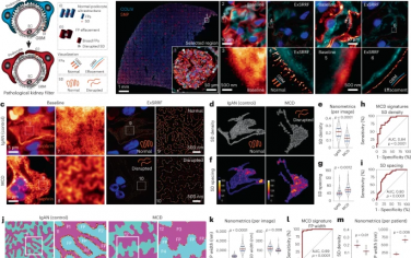 Nature Nanotechnology：扩展增强的超分辨率径向波动能够实现病理标本的纳米级分子图谱