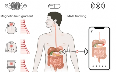 Nature Electronics: 用于胃肠动力学无线监测的位置感知可摄入微型设备