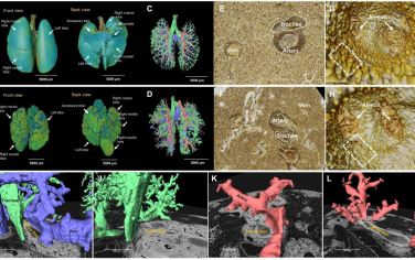 Science Advances：利用全肺图谱在单细胞水平上对纳米颗粒和肿瘤进行跨尺度示踪