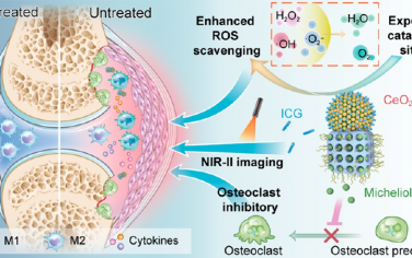 ACS Nano：多功能Janus纳米平台用于类风湿性关节炎的高效协同诊疗