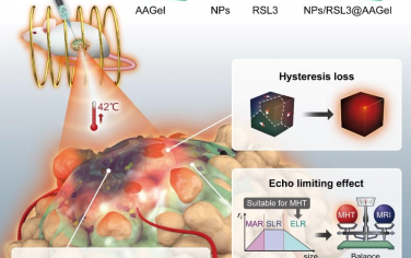 Biomaterials：可注射的活性水凝胶诱导实现相互增强的轻度磁热疗和铁死亡