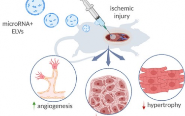 ACS Nano： 在细胞外囊泡衍生载体上定制装载microRNA-126以改善心肌梗死后的心功能