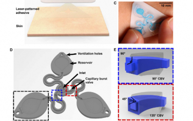 Science Advances：具有空间工程 3D 流体的皮肤接口微流体系统，用于汗液捕获和分析