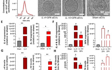 Advanced Materials：皮肤成纤维细胞衍生工程化细胞外囊泡可缓解炎症