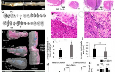 Biomaterials：明胶海绵支架可在脊柱损伤后进行有效组织重塑