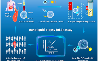 施剑林院士ACS Nano：基于双肿瘤外体生物标记物共识别的纳米液活检准确早期诊断癌症