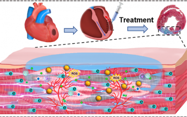 ACS Nano：包裹Au@Pt纳米颗粒的水凝胶用于调节梗死微环境和增强干细胞的治疗效果
