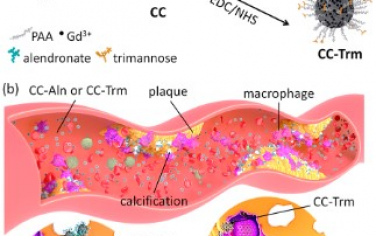 ACS Nano：超小碳酸钙纳米颗粒靶向成像动脉粥样硬化斑块的比较研究