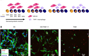 Biomaterials：肿瘤相关巨噬细胞在机械可调谐的骨肉瘤工程模型中诱导炎症和耐药性