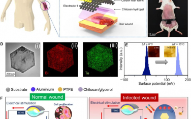 Science Advances: 一种用于主动预防感染和加速伤口愈合的自供电多功能敷料