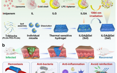 ACS Nano：集成了NIR-II响应性纳米杂化体的热敏水凝胶可作为可喷涂敷料以实现耐药细菌感染伤口管理