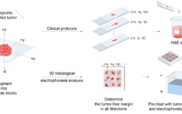 Nano Letters：三维组织电泳可实现高通量癌缘检测