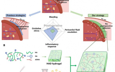 Science Advances：可注射光固化Janus水凝胶递送hiPSC心肌细胞衍生外体用于心脏手术后粘连减少