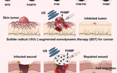 Biomaterials：超声活化纳米声敏剂实现氧/硫酸盐双自由基纳米疗法