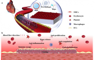 Biomaterials： 通过cGMP-PKG和nf - κ B信号通路实现血管愈合和免疫调节的仿生纳米颗粒涂层