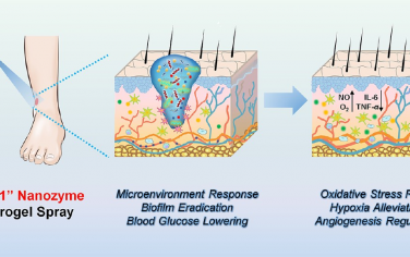 ACS Nano：超声增强多重类酶活性的纳米酶水凝胶喷雾用于促进糖尿病伤口愈合